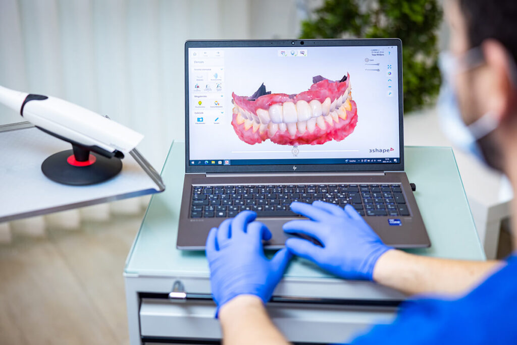 Oral Scan Prüfung bei Artdent Zahnklinik, Budapest